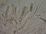Sphaerostilbella berkeleyana image