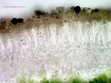 Melanohalea multispora image