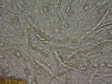Sphaerostilbella berkeleyana image