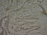 Sphaerostilbella berkeleyana image