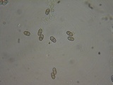 Sphaerostilbella berkeleyana image