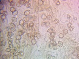 Nolanea verna var. isodiametrica image
