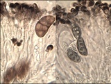Diplotomma chlorophaeum image