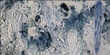 Lecanographa grumulosa image