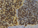 Caloplaca ochracea image