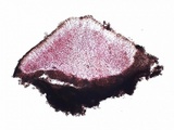 Miriquidica deusta image