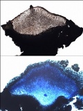 Miriquidica deusta image