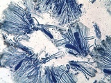 Miriquidica deusta image