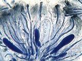Miriquidica deusta image