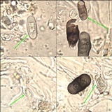 Rinodina teichophila image