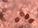 Lacrymaria echiniceps image