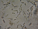 Natantiella ligneola image