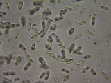 Natantiella ligneola image