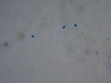Pachycudonia monticola image