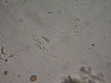 Hyphodontia subalutacea image