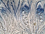 Caloplaca variabilis image