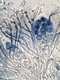 Caloplaca variabilis image