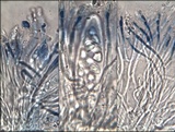 Caloplaca variabilis image