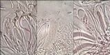 Micarea micrococca image