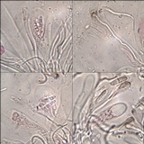 Micarea micrococca image