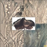 Lecidella elaeochroma f. elaeochroma image
