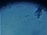 Dematioscypha dematiicola image