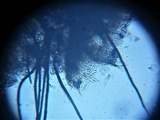 Dematioscypha dematiicola image