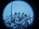 Dematioscypha dematiicola image