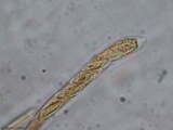 Cudoniella clavus image