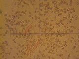 Inocybe griseolilacina image