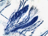 Placynthium nigrum image