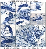 Placynthium nigrum image