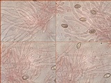 Hebeloma bulbiferum image