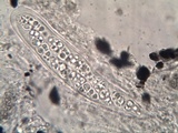 Hysterobrevium smilacis image