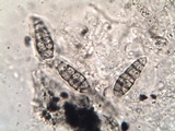 Hysterobrevium smilacis image