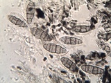 Hysterobrevium smilacis image