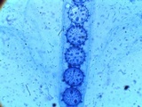 Scutellinia legaliae image