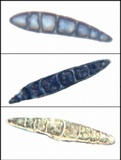 Micarea lignaria var. lignaria image