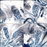 Lecania aipospila image