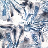 Lecania aipospila image