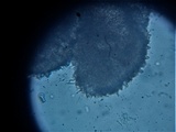 Vezdaea leprosa image