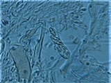 Vezdaea leprosa image