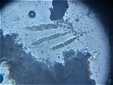 Pseudovalsa lanciformis image