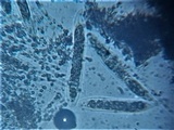 Pseudovalsa lanciformis image