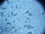 Pseudovalsa lanciformis image