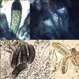 Buellia disciformis image