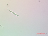 Bacidia heterochroa image
