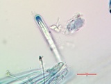 Bacidia heterochroa image