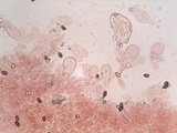 Coprinopsis pannucioides image
