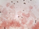 Coprinopsis pannucioides image